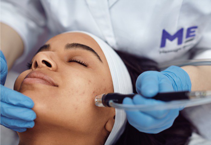 What is a microderm infusion