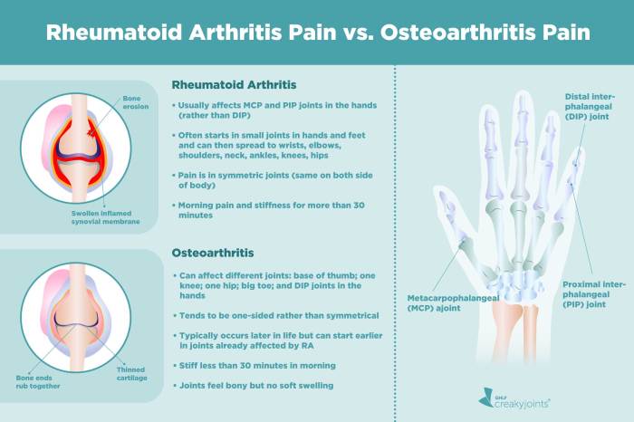 The nurse understands that which information is correct about osteoarthritis